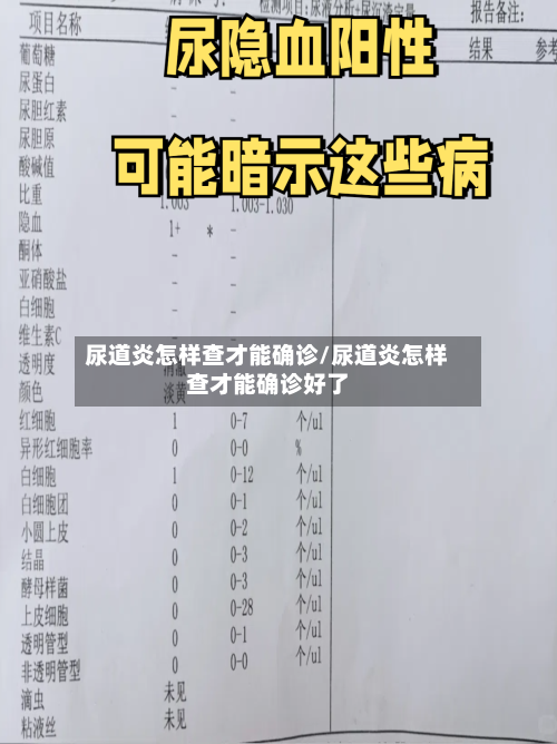尿道炎怎样查才能确诊/尿道炎怎样查才能确诊好了-第2张图片